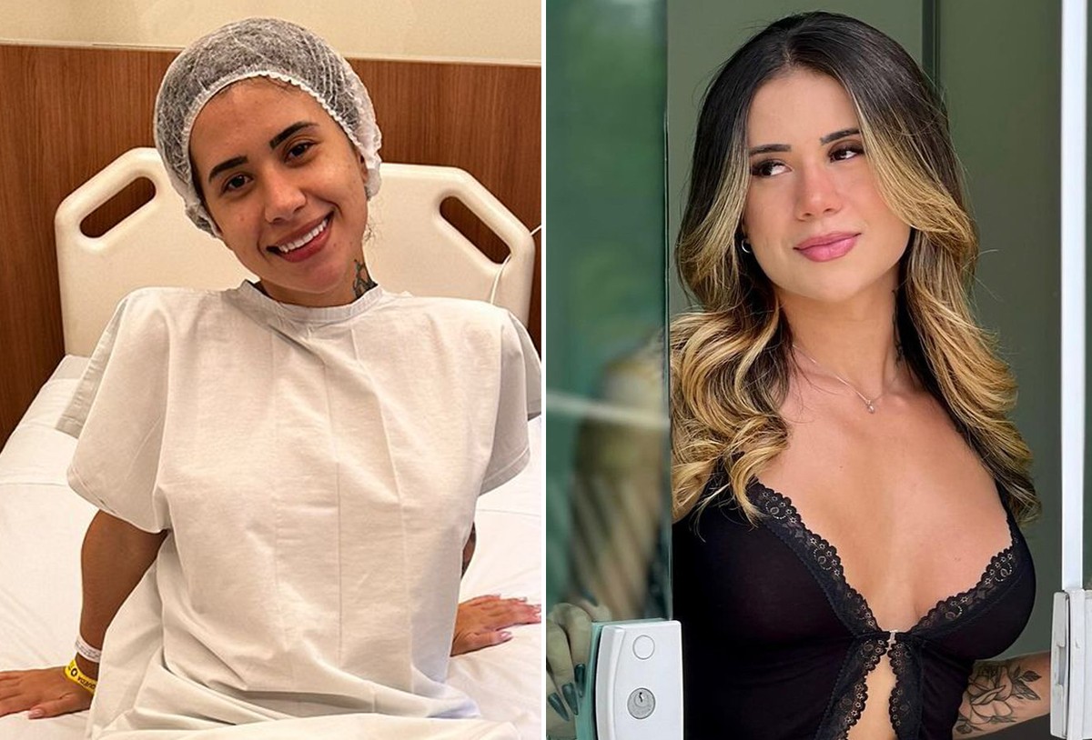 Atual Miss Bumbum reduz lábios da vagina e aumenta próteses de silicone