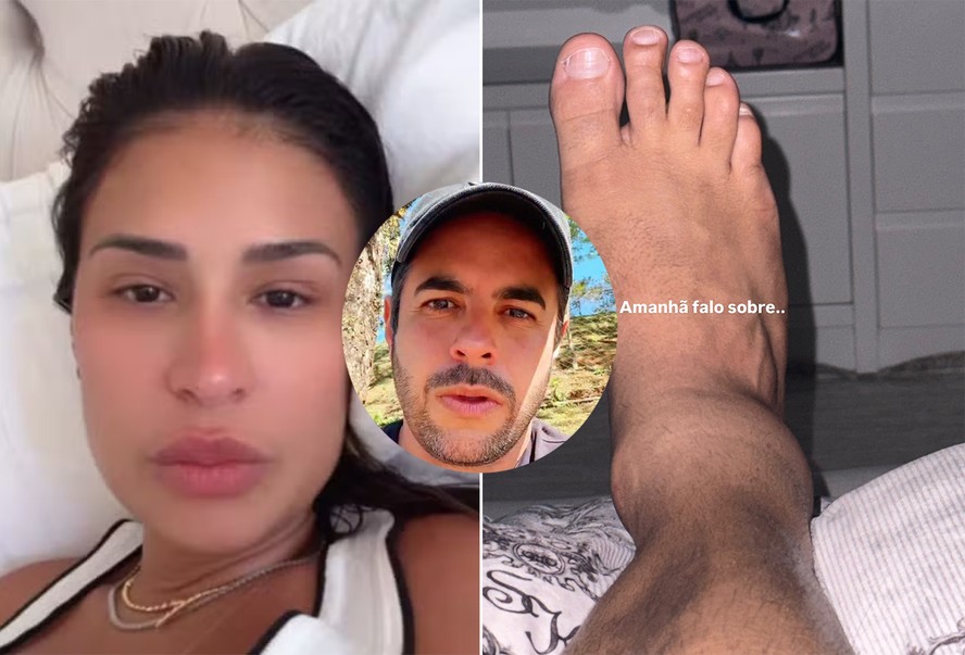 Simone Mendes é internada com gastrointerite e o marido, Kaká Diniz, é hospitalizado após lesão no tornozelo