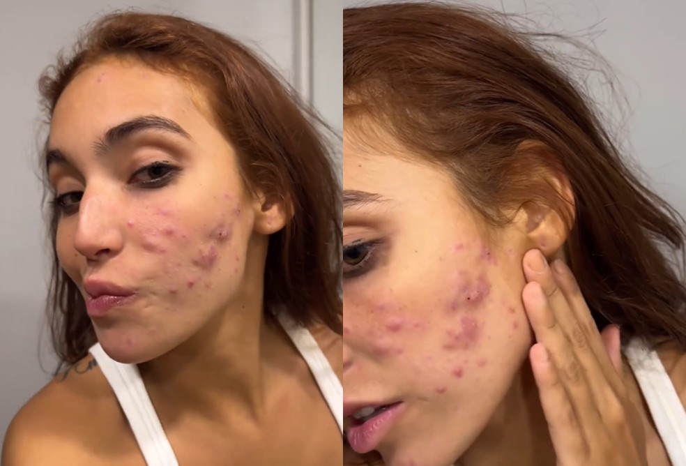 Vanessa Lopes mostra pele natural — Foto: Reprodução/Instagram