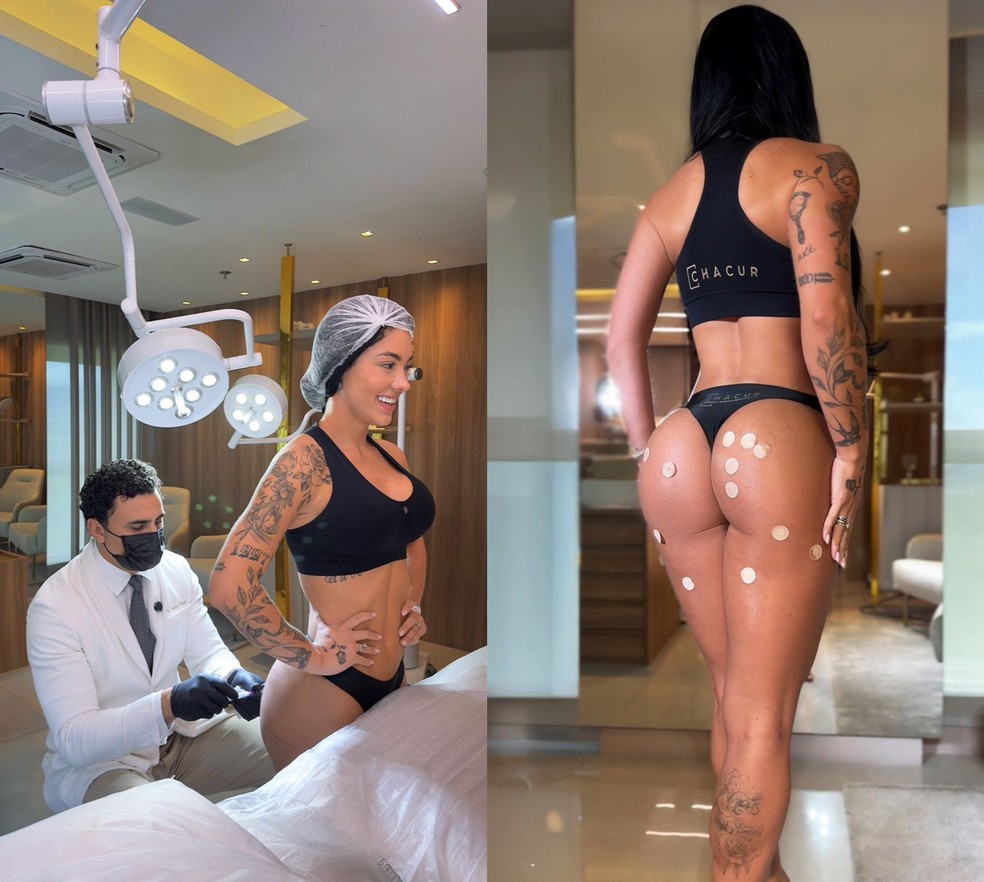 Rayane Figliuzzi — Foto: @rayfigliuzzi | @drchacur | CO ASSESSORIA