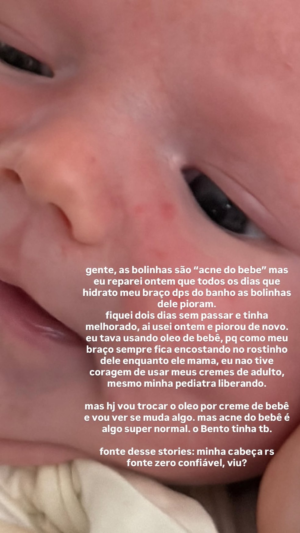 Isa Scherer explicou bolinhas no rosto do filho, Tom — Foto: Reprodução/Instagram