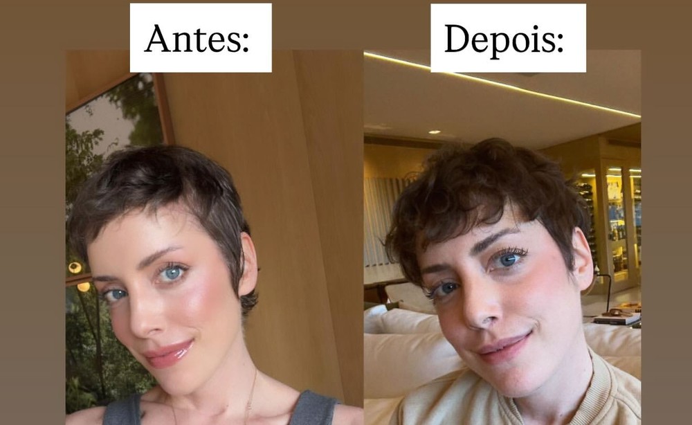 Fabiana Justus compara antes e depois ao falar dos efeitos do uso de ...