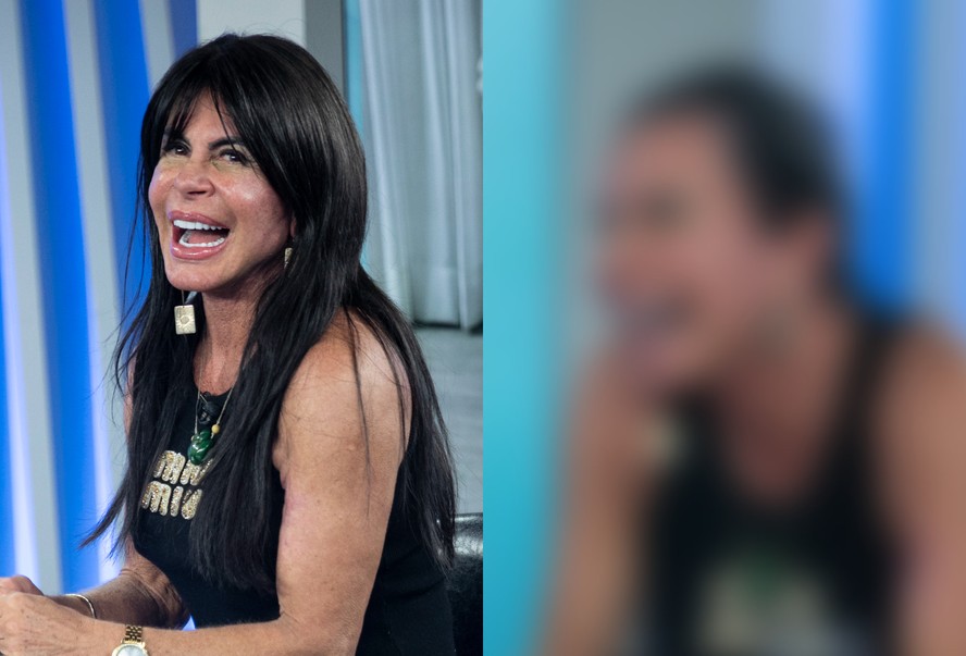 Gretchen mostra resultado de implante capilar