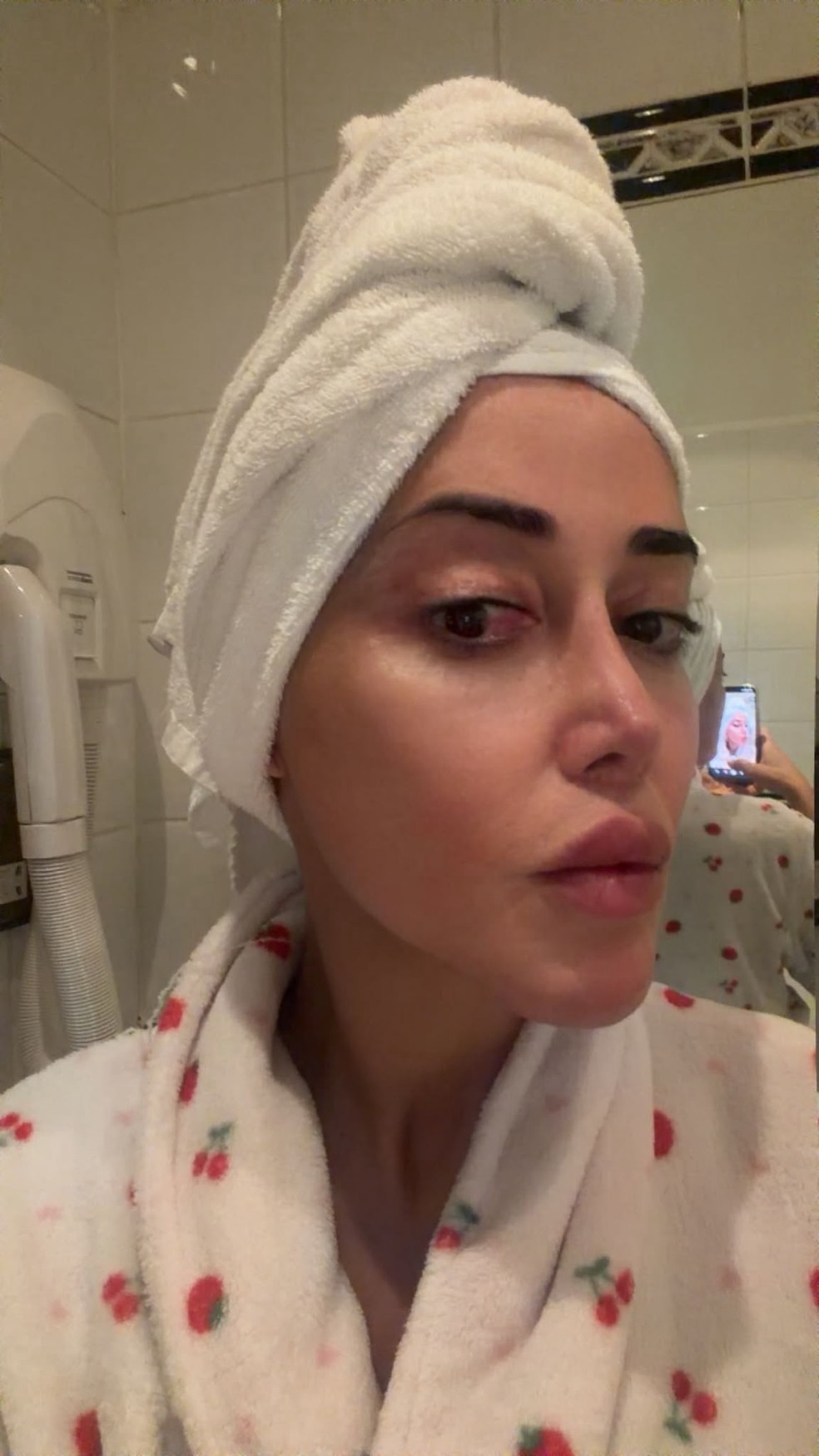 Marcela Porto, a Mulher Abacaxi, depois da feminização facial — Foto: Arquivo pessoal
