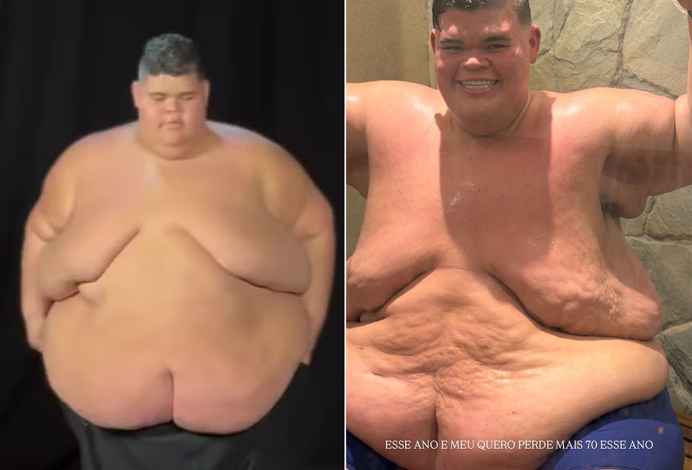 Gordão da XJ antes (350 kg) e depois (210 kg) de perder 140 kg — Foto: Reprodução/Instagram