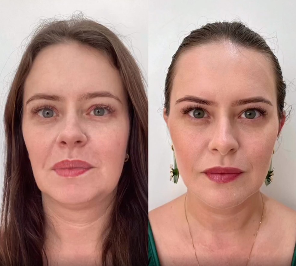 Antes e depois de Mari Bridi — Foto: Instagram