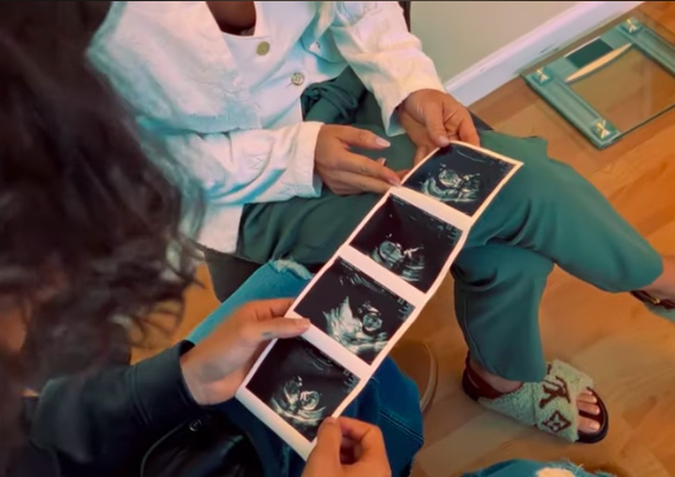 Ultrassom da primeira filha de Maluma &mdash; Foto: Reprodu&ccedil;&atilde;o