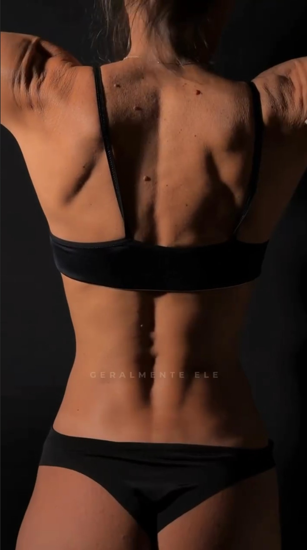 Ketryn Goetten mostra antes e depois — Foto: Reprodução/Instagram