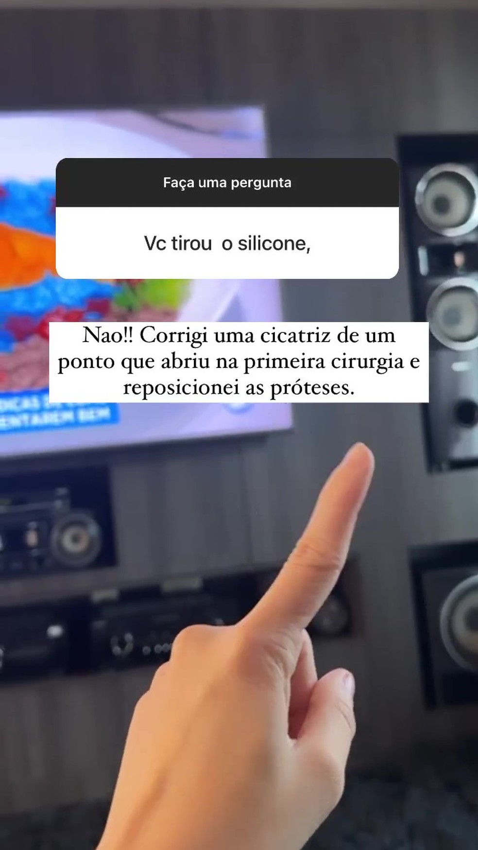 Maria Lina fala de procedimento para reposicionar pr&oacute;teses de silicone &mdash; Foto: Instagram
