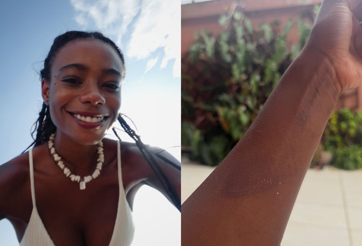 Modelo Dandara Couto mostra marcas pelo corpo após ficar três dias desaparecida: 'Não aguentava mais'