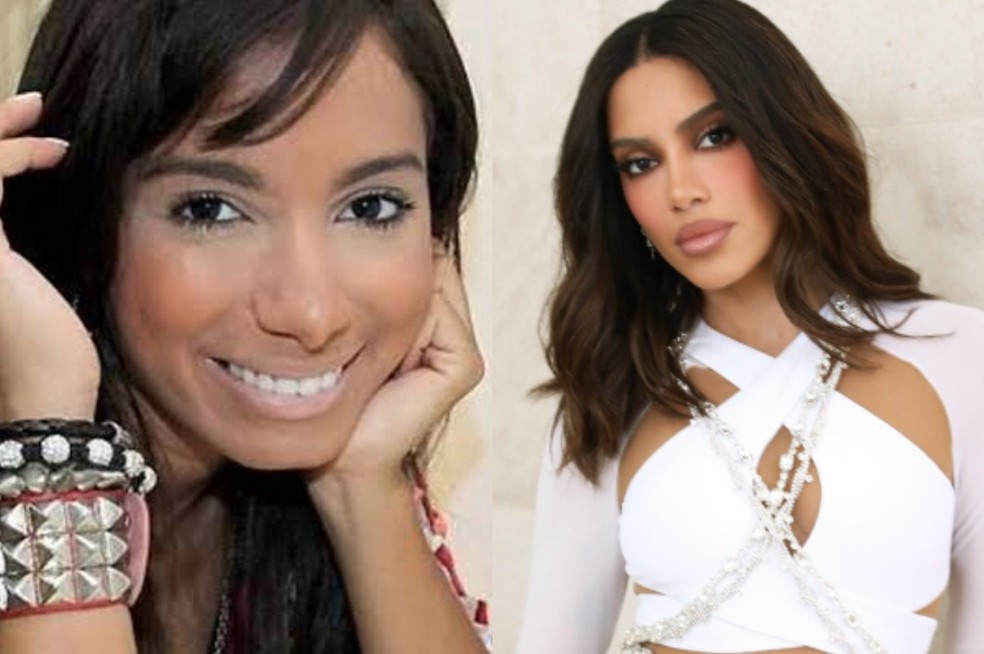 Antes e depois de Anitta — Foto: Reprodução/Instagram