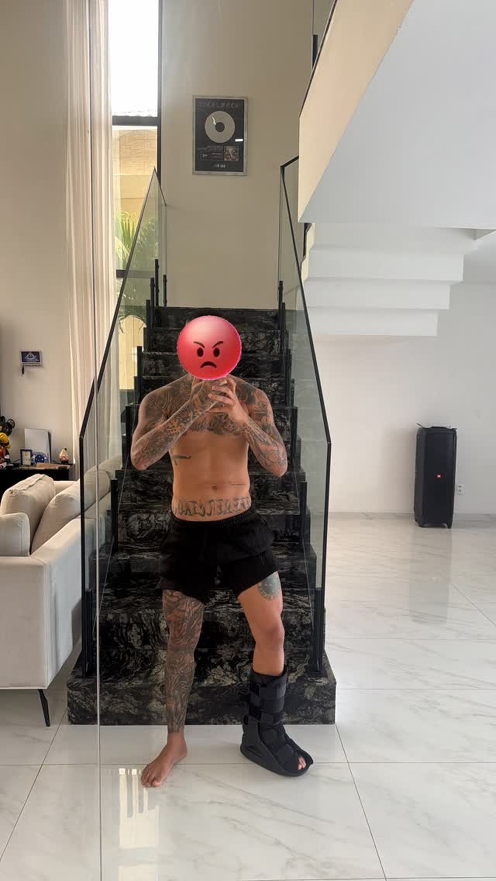 Anderson Neiff se lesionou jogando futebol — Foto: Reprodução/Instagram