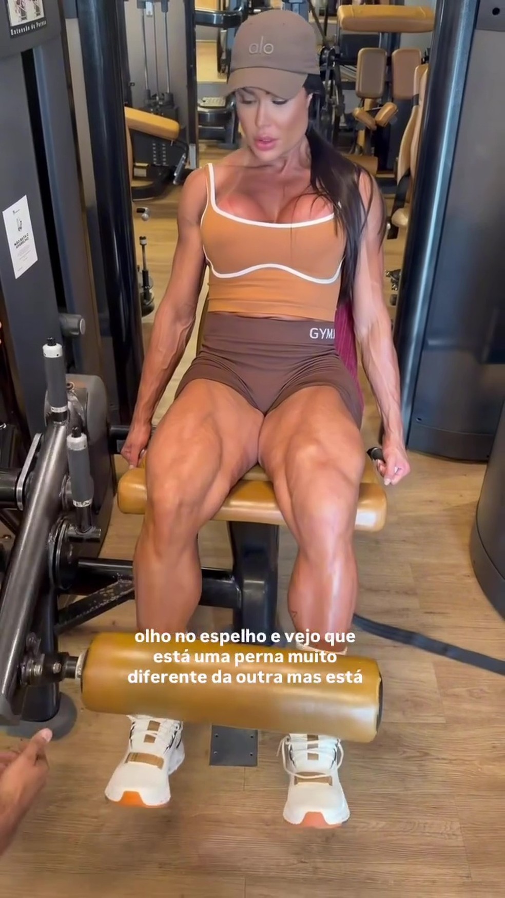 Gracyanne faz balanço seis meses após cirurgia no joelho — Foto: Reprodução/Instagram