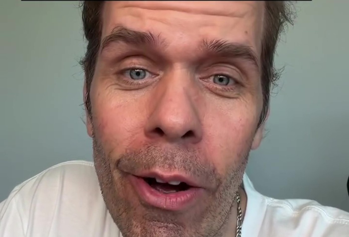 Perez Hilton, internado desde automutilação, 