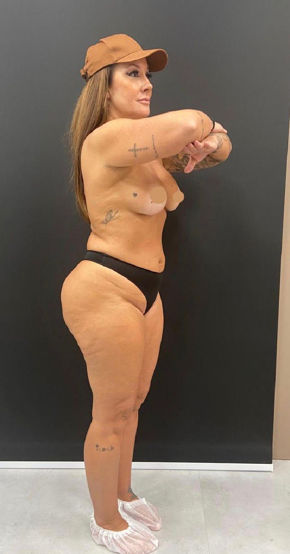 Vivi Fernandez antes de cirurgias plásticas — Foto: Divulgação