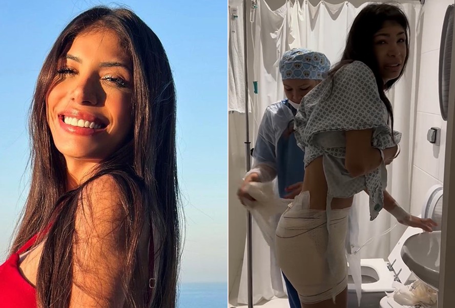 MC Princesa faz quinta cirurgia para retirar PMMA de glúteos; imagens