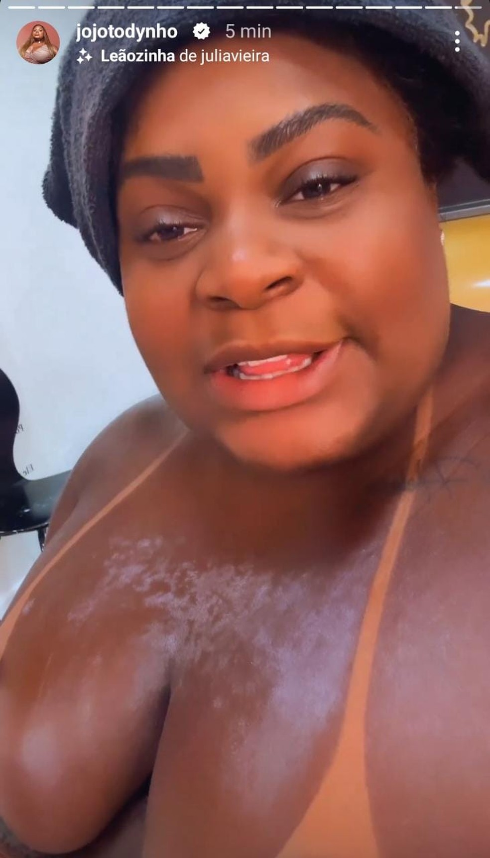 Jojo Todynho exibe resultado de bronzeamento de fita — Foto: Reprodução/Instagram