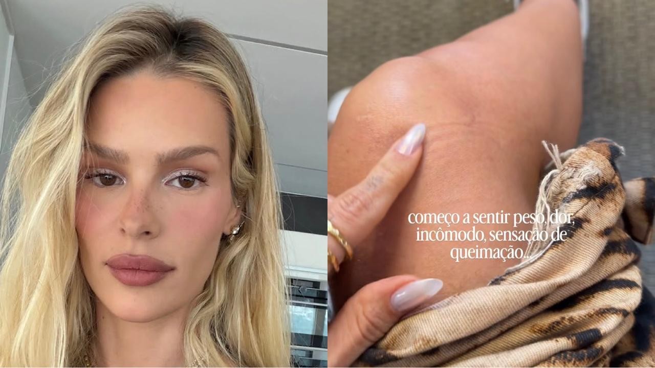 Yasmin Brunet desabafa sobre lipedema: 