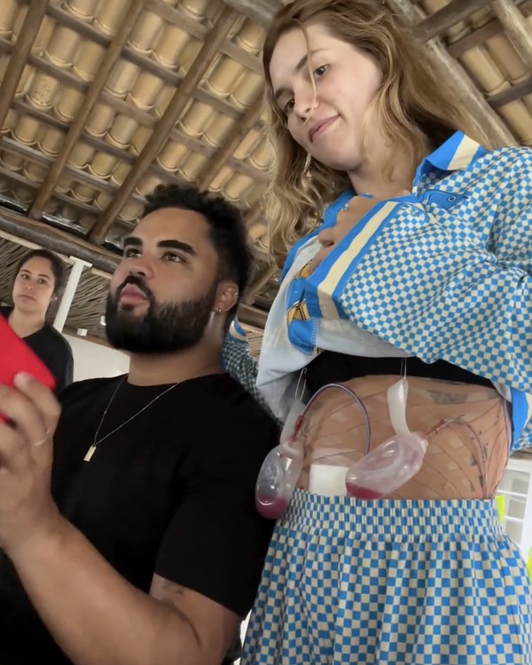 Após cirurgia, Virginia deixa Lucas Guedez em pânico ao mostrar dreno na barriga