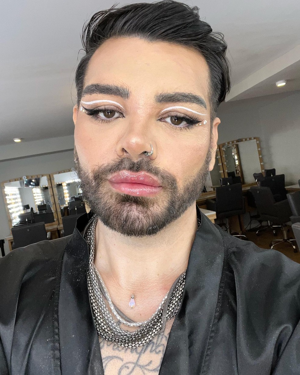 Fran Mariano após cirurgias plásticas para se parecer com Ricky Martin — Foto: Instagram