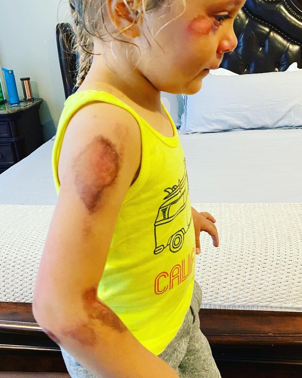 Ava, filha de Alfonso Ribeiro, sofreu acidente e foi submetida a cirurgia de emergência — Foto: Reprodução / Instagram