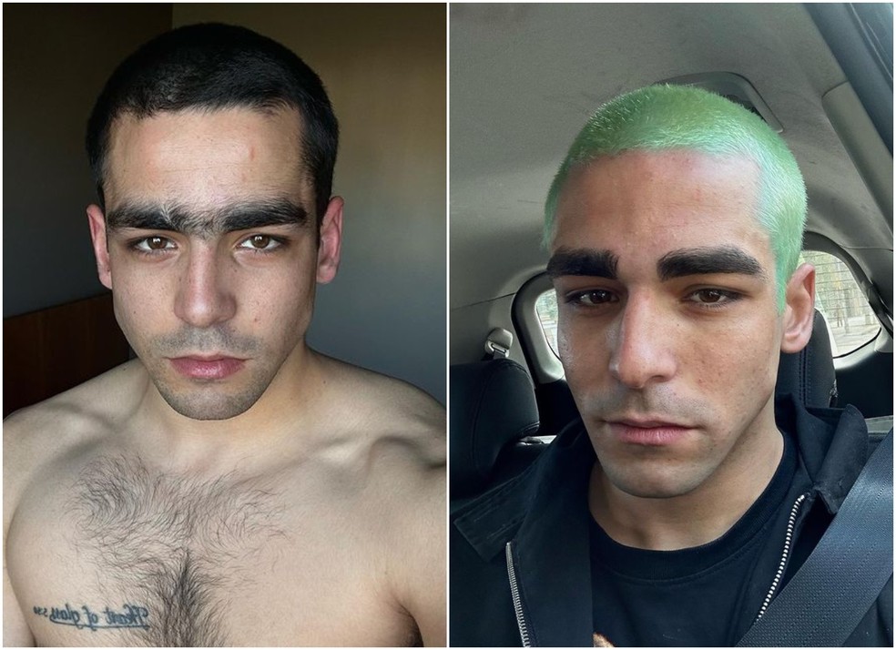 Antes e depois de Omar Ayuso — Foto: Instagram