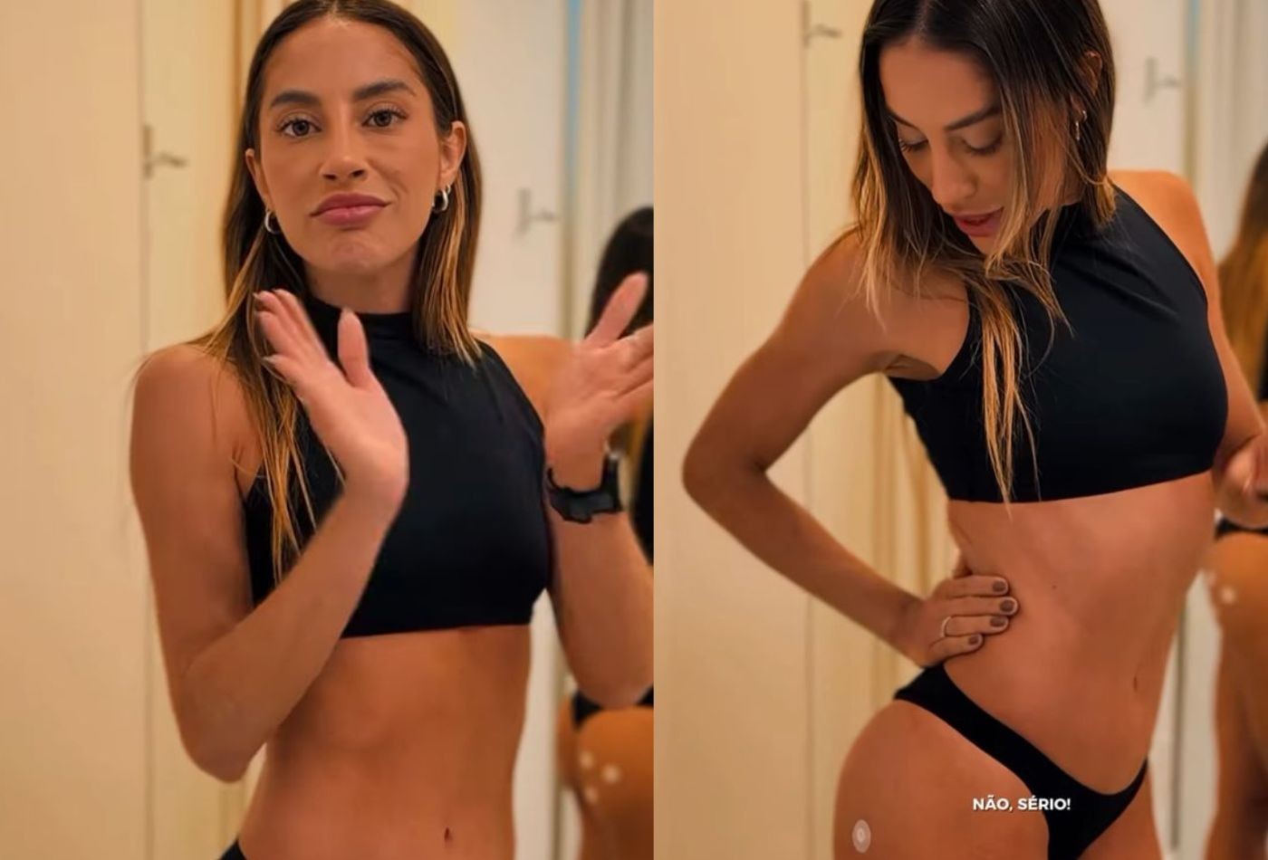 Campeã do BBB 25, Renata Saldanha faz procedimento no bumbum e exibe resultado: 