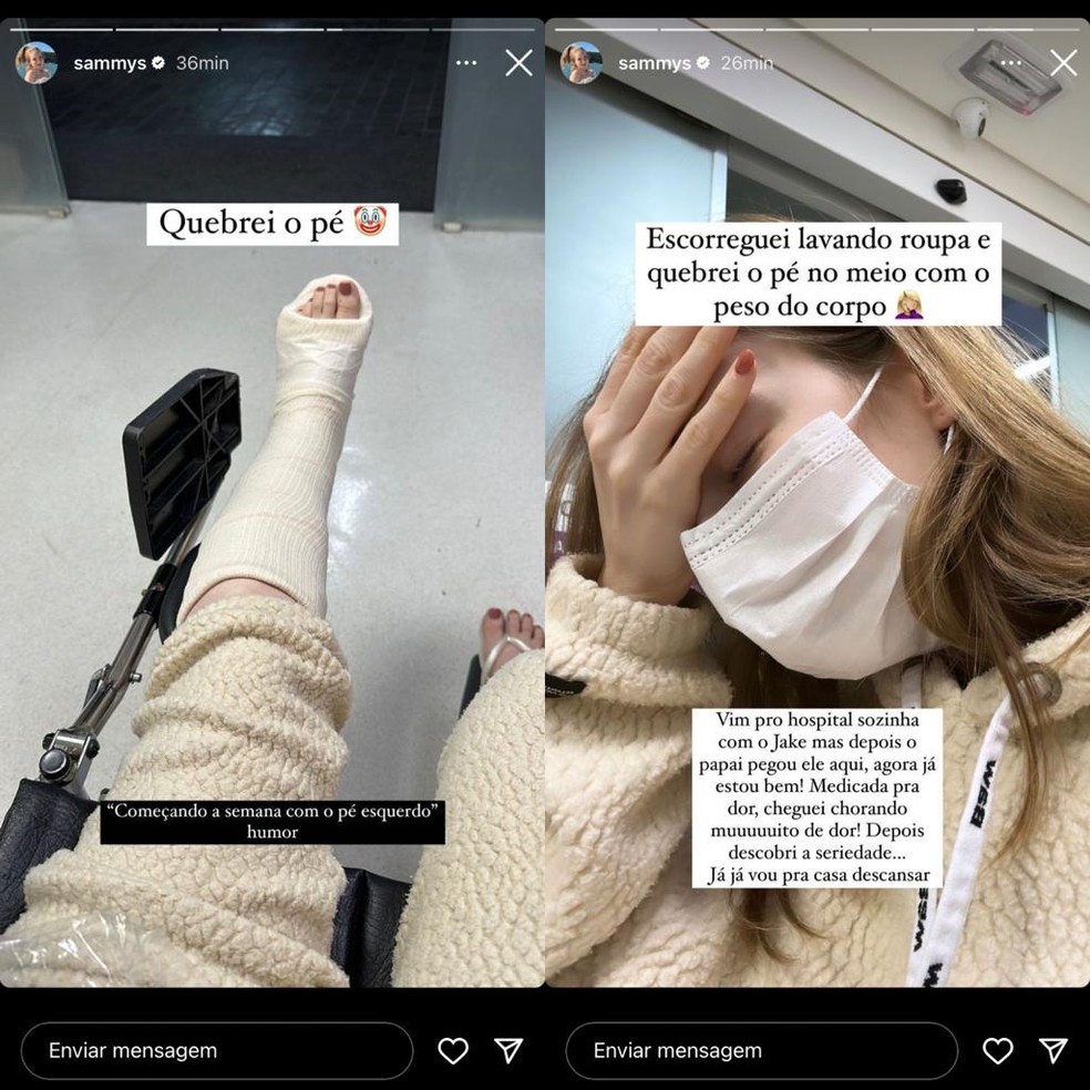 Sammy sofre acidente doméstico e fratura o pé — Foto: Reprodução/Instagram