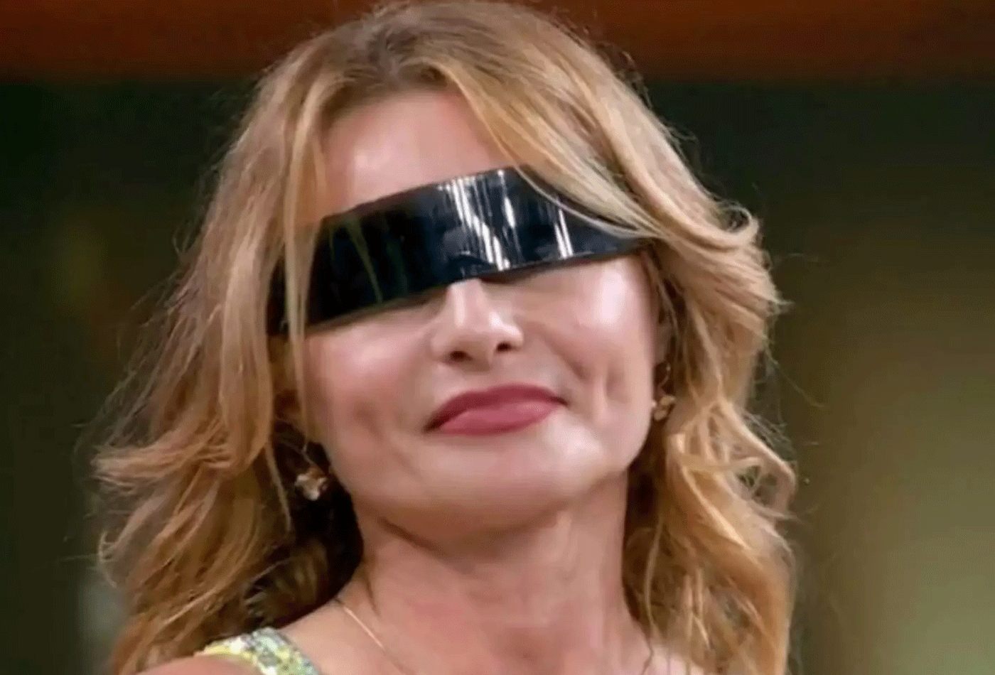 Complicações após blefaroplastia de Rita Guedes podem ameaçar a visão? Entenda - QTU Questões do Universo