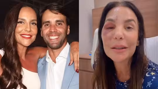 Daniel Cady tranquiliza fãs e celebra recuperação de Ivete Sangalo: 'Mulher de aço'