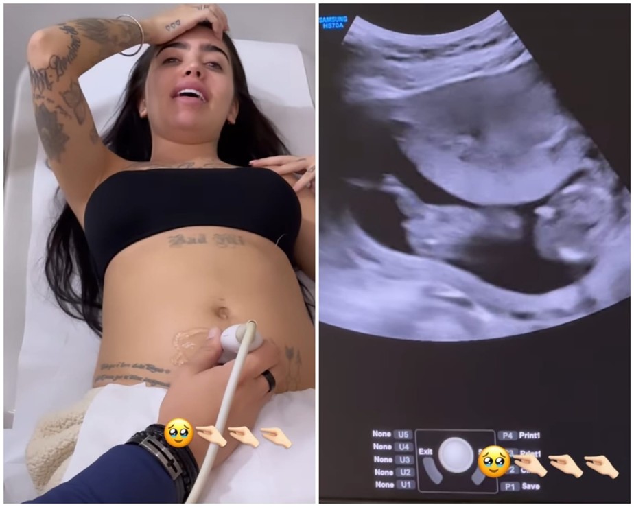 Grávida, Mc Mirella faz ultrassom e se surpreende com reação de feto