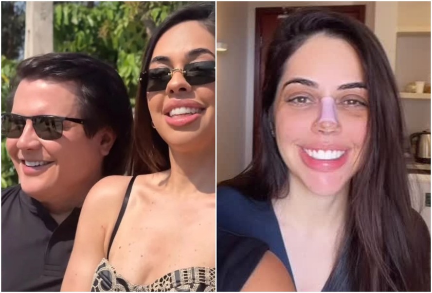 Flavinha Correia, namorada de Giovani, fez uma rinoplastia