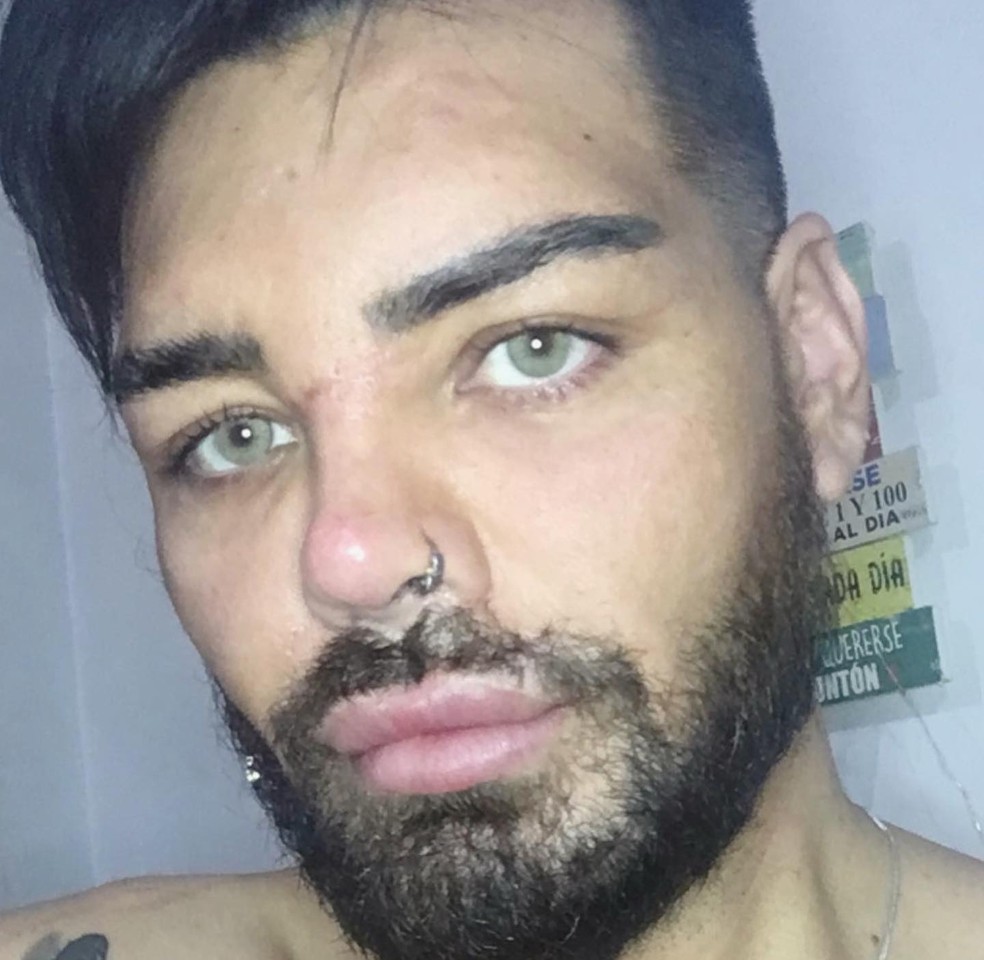 Fran Mariano após cirurgias plásticas para se parecer com Ricky Martin — Foto: Instagram