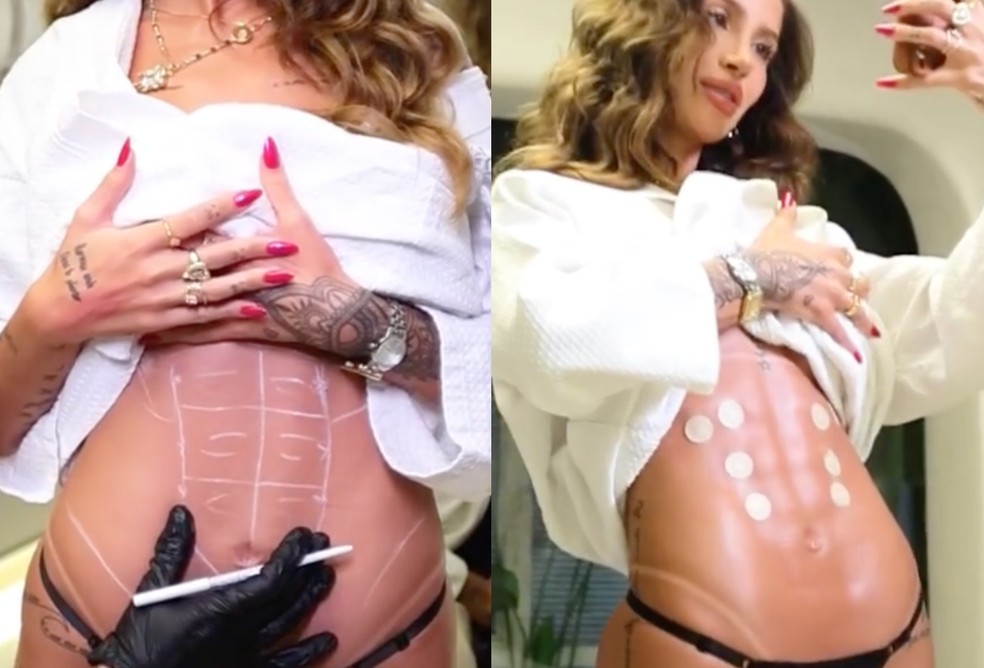 Antes e depois do abdômen de Bianca Andrade — Foto: Reprodução/Instagram