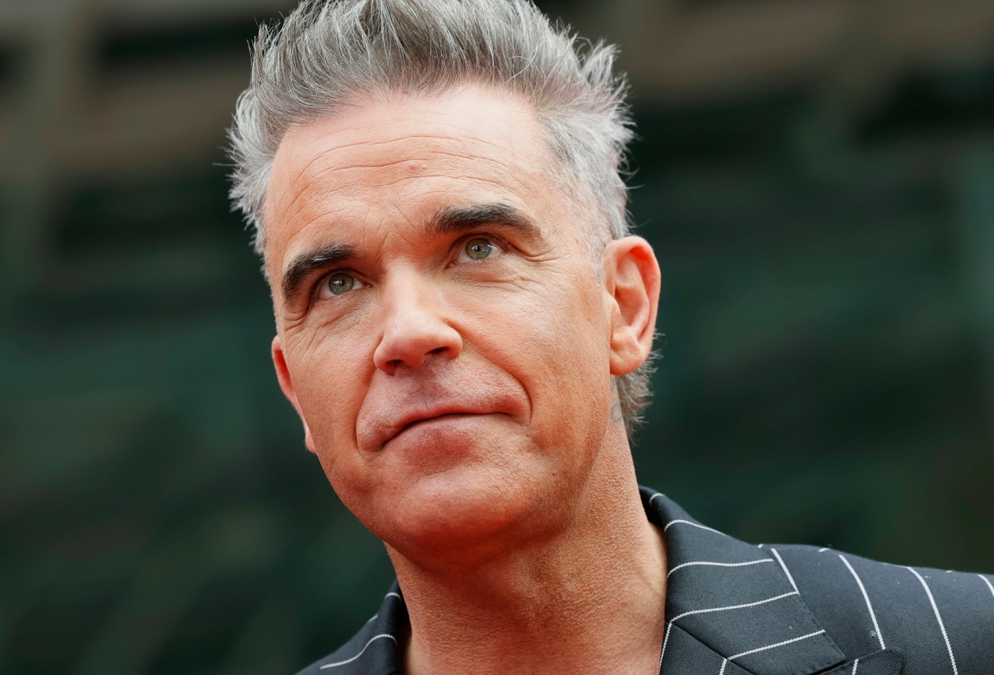 Robbie Williams justifica insegurança por queda de cabelo: 