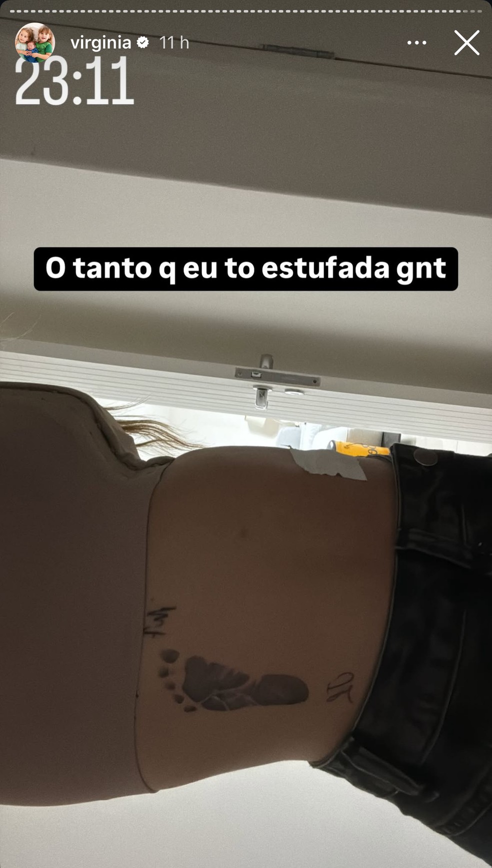 Virginia Fonseca mostra a barriga inchada por conta de cirurgia estética — Foto: Reprodução/Instagram