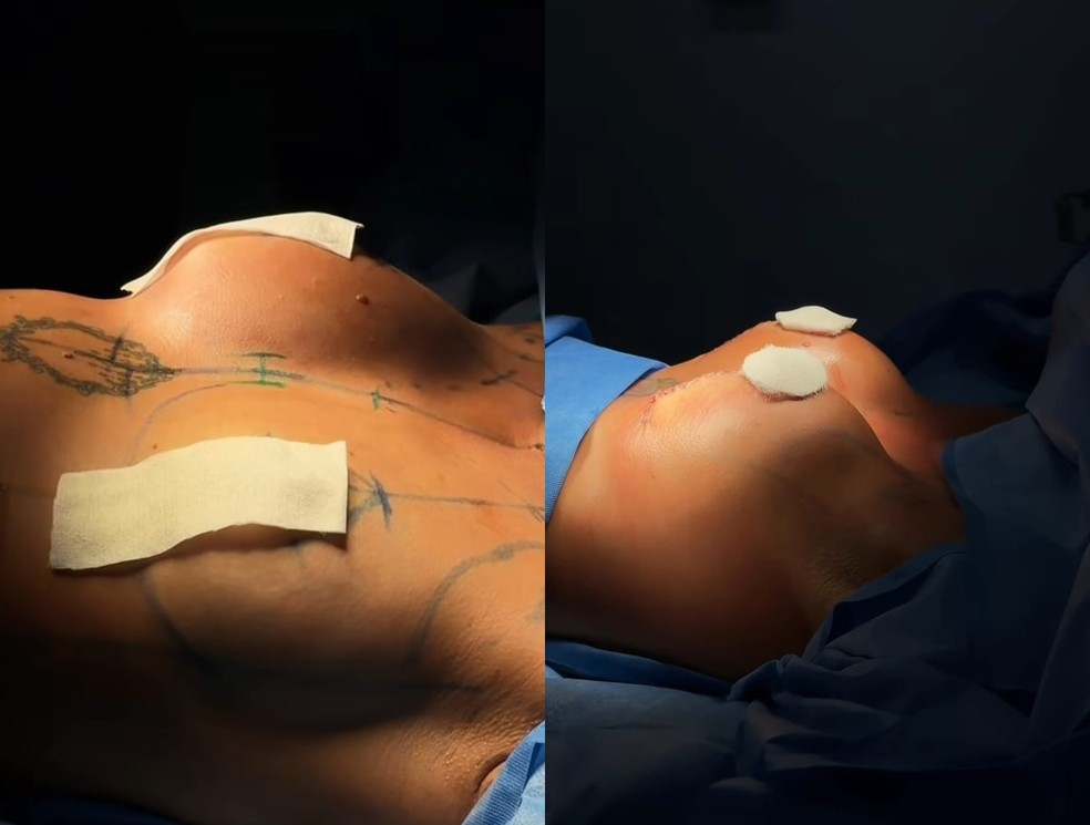 Maxiane: antes e depois — Foto: Reprodução/Instagram