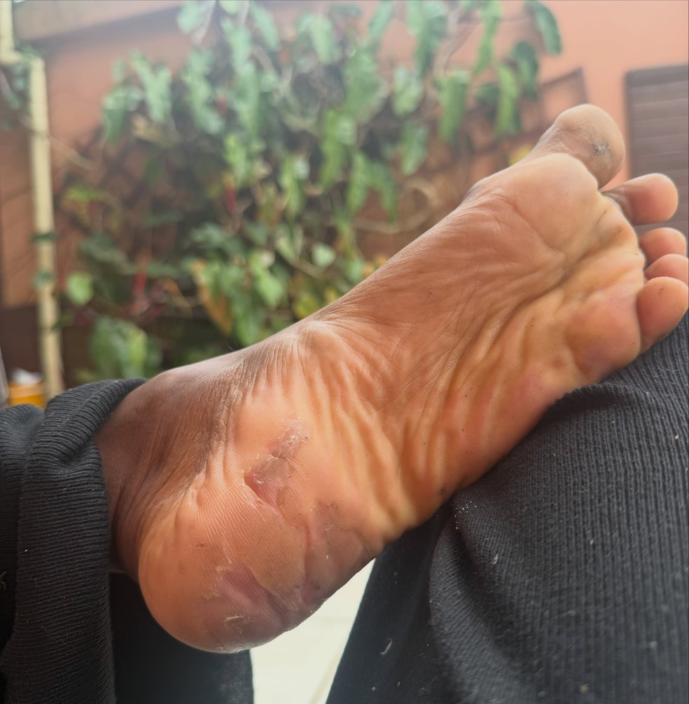 Modelo Dandara Couto mostra marcas pelo corpo após ficar três dias desaparecida — Foto: Reprodução/Instagram