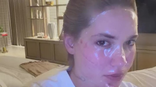 Virginia Fonseca passa por bateria de procedimentos estéticos e brinca: 'Direito de ser feia'