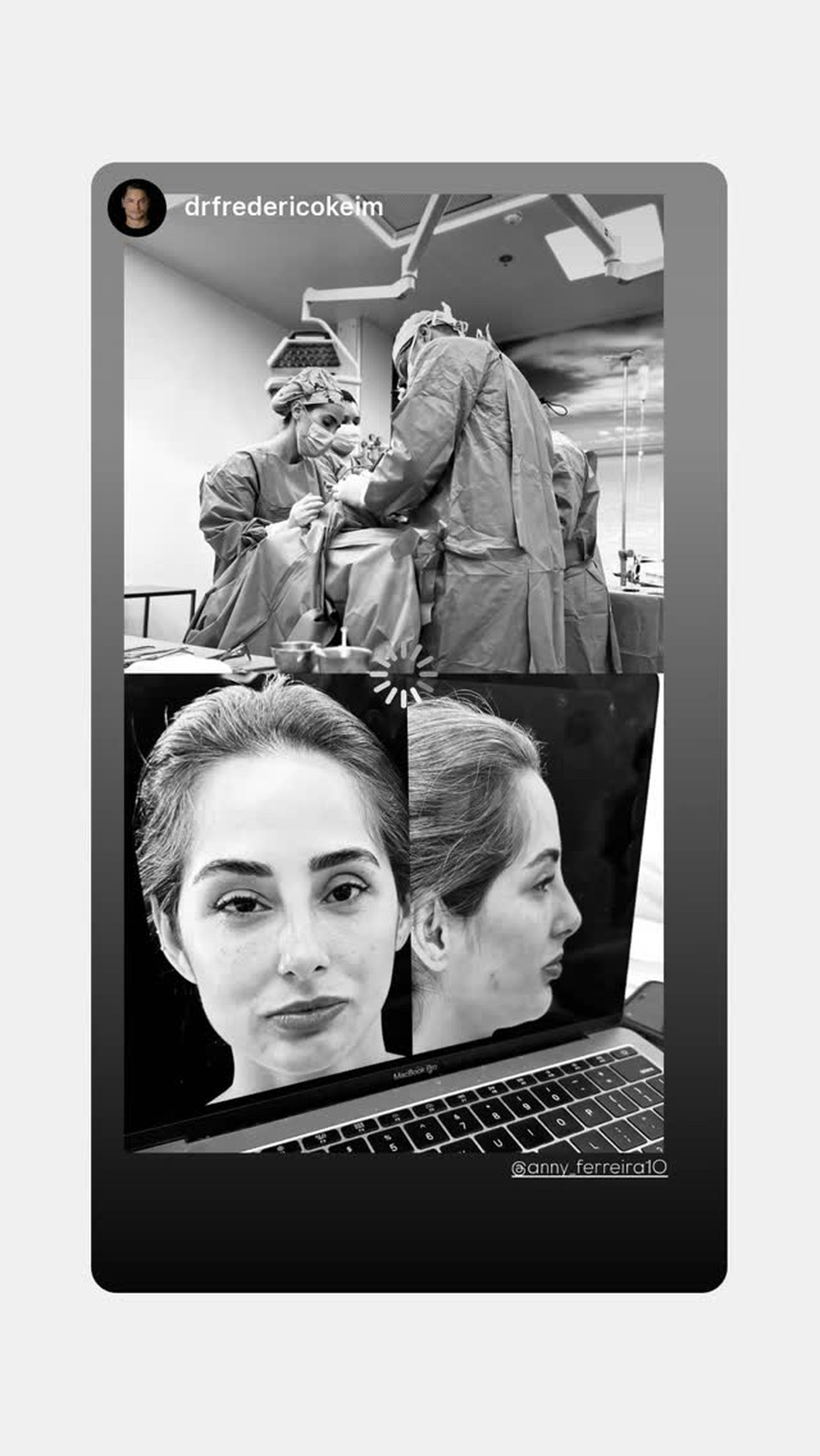 Previsão de como o nariz de Deniziane vai ficar — Foto: Reprodução/Instagram