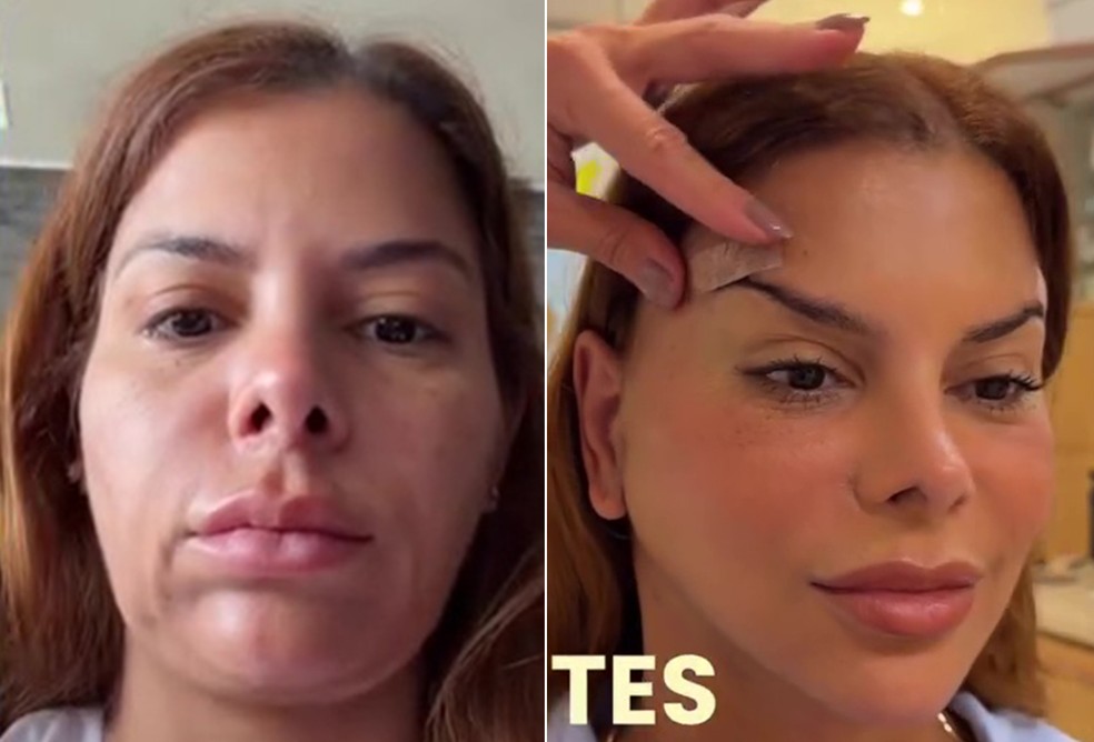 Antes e depois de Evelyn Regly — Foto: Reprodução/Instagram
