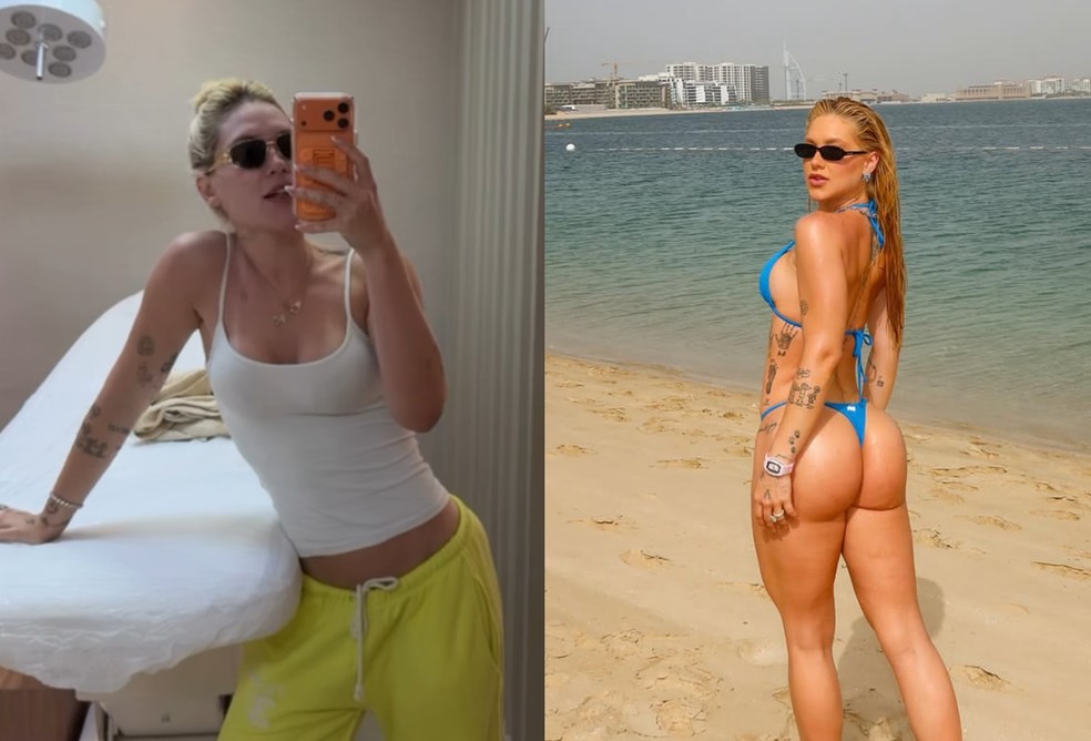 Virginia retorna ao Brasil e faz procedimento no bumbum — Foto: Reprodução/Instagram