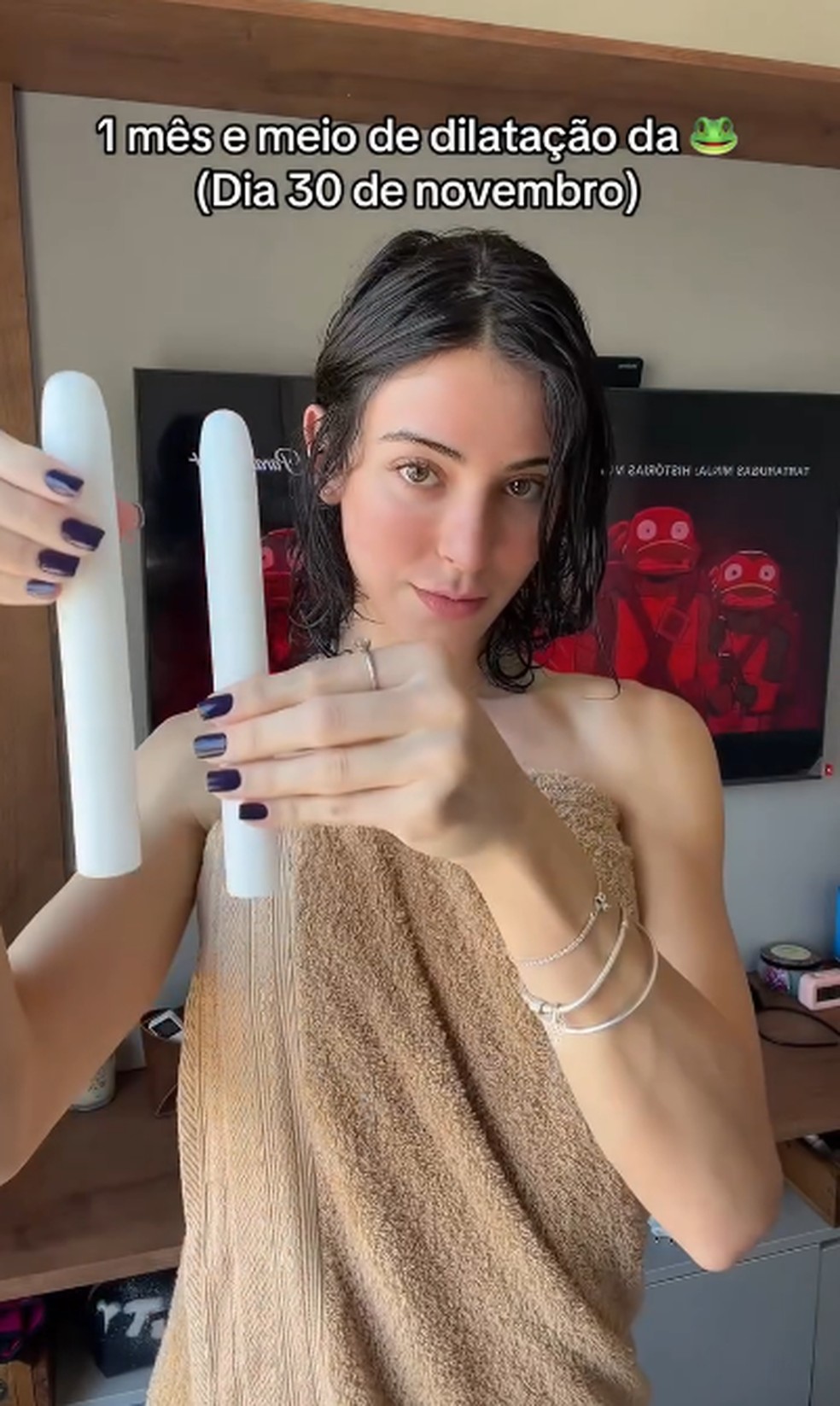 Bella Longuinho com os dilatadores — Foto: Reprodução/Instagram