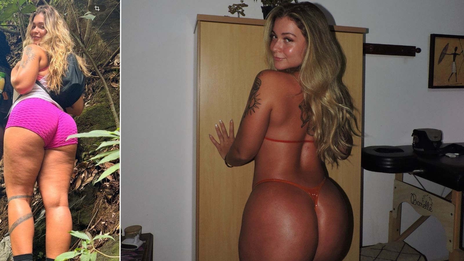 Miss Bumbum 2026 diz que descobriu lipedema antes do concurso: 'Tomei um susto'