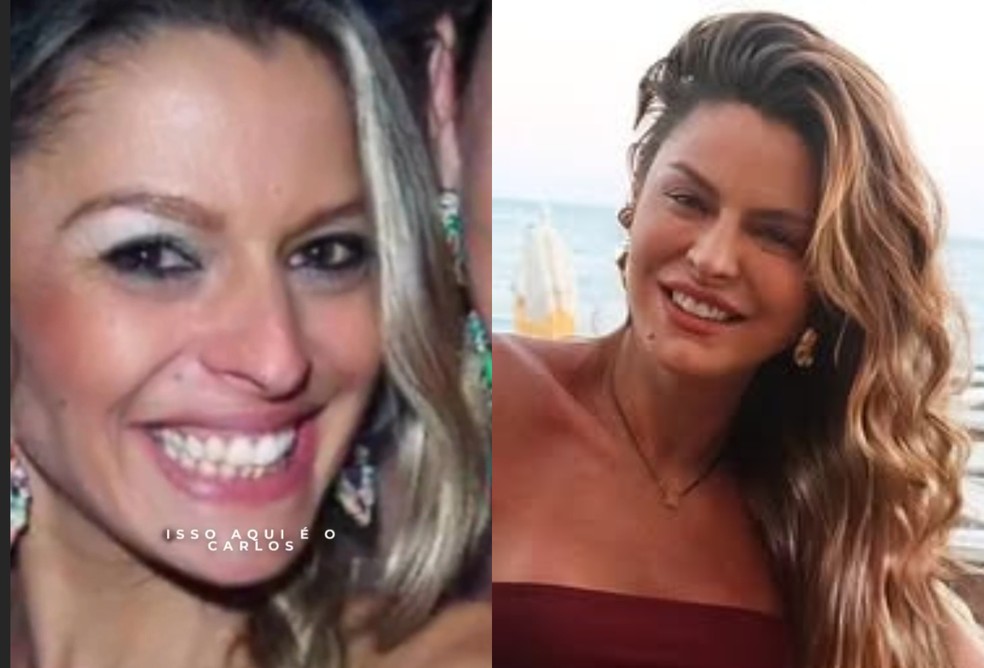 Ketryn Goetten antes e depois de procedimentos estéticos que realizou — Foto: Reprodução/Instagram