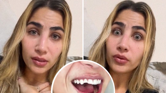 'Noite romântica seguida de desastre': filha de Leonardo relata como quebrou o dente após 'mistura bem perigosa'