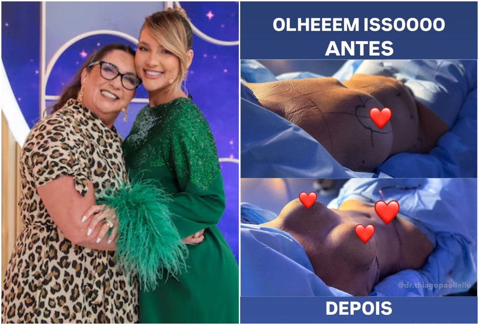 Virginia Fonseca mostrou antes e depois da mãe, Margareth Serrão — Foto: Reprodução/Instagram