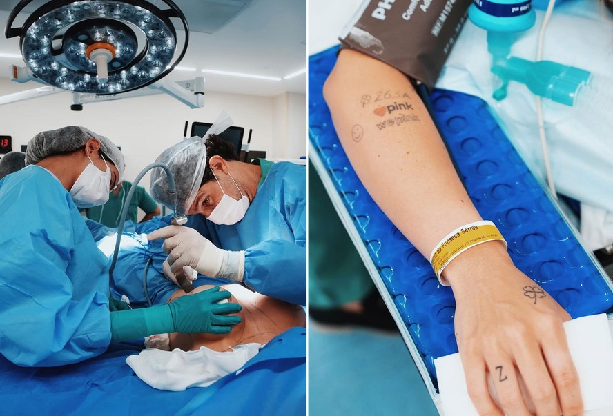 Cirurgião de Virginia Fonseca detalha procedimentos feitos pela influencer; cirurgias duraram quase 8 horas