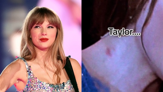 Taylor Swift viraliza com 'chupão' no pescoço