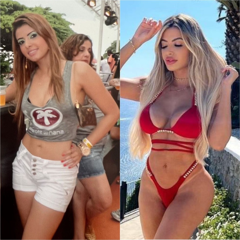 Janaina Prazeres antes e depois dos procedimentos estéticos — Foto: Divulgação / CO - Assessoria
